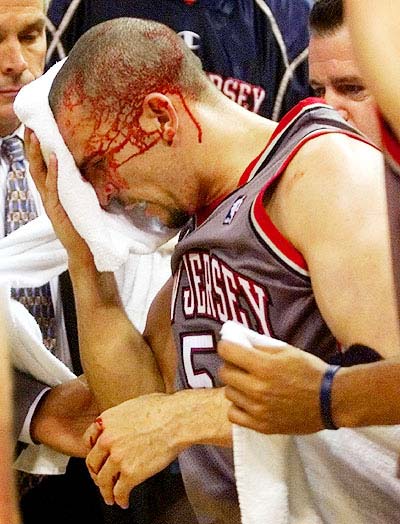 Kidd on his way to the locker room after the collision.